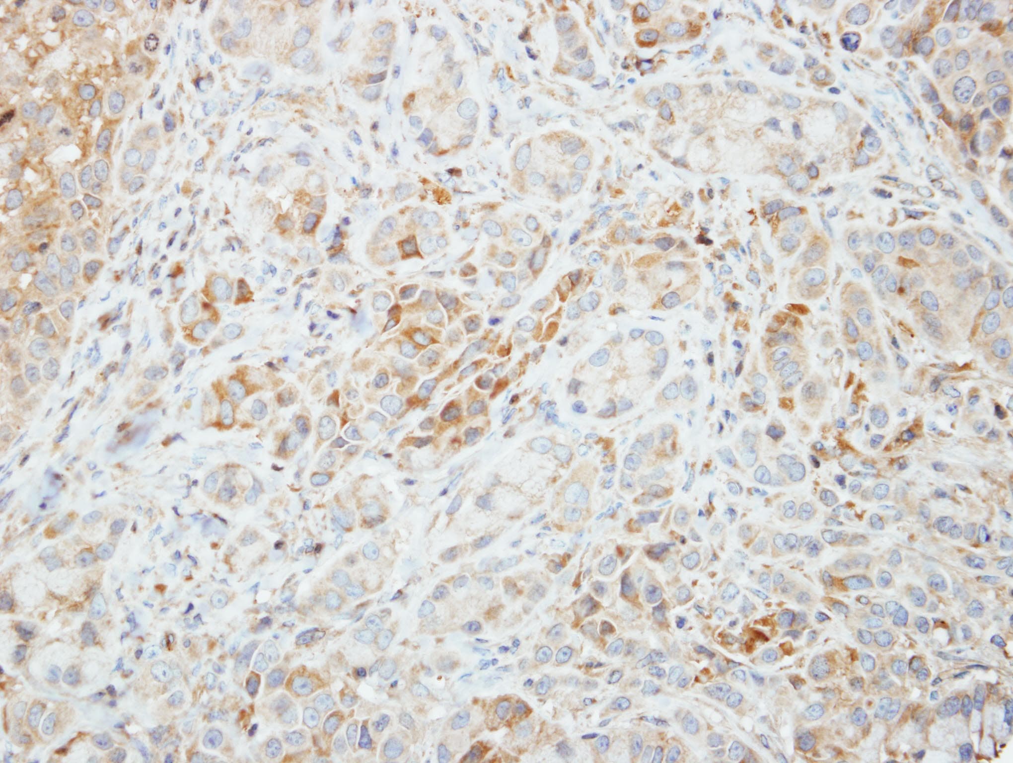 Polyclonal Rabbit anti-Human PRKAA2 / AMPK Alpha 2 Antibody (aa29-510, IHC, WB)