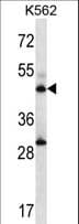 ADSS Antibody (aa396-422)