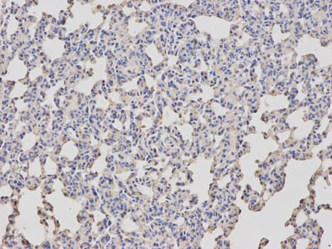 Polyclonal Rabbit anti-Human ARRB1 / Beta Arrestin 1 Antibody (IHC, IF, WB)