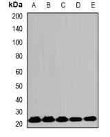 Polyclonal Rabbit anti-Human HPRT1 / HPRT Antibody (WB)