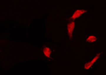 CDC25B Antibody
