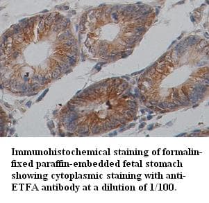 ETFA Antibody (Internal)