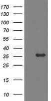 Monoclonal Mouse anti-Human MGLL / Monoacylglycerol Lipase Antibody (clone OTI 2B6, IHC, WB)
