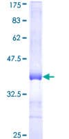 Human RFWD2 / COP1 Protein (Recombinant GST, N-terminus)