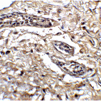 BCL9L Antibody