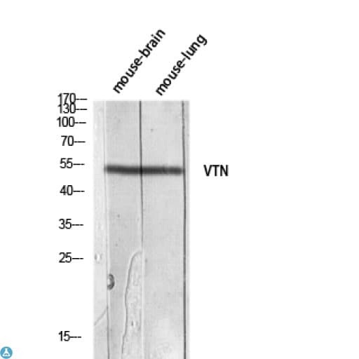 VTN / Vitronectin Antibody