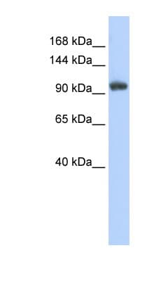 Polyclonal Rabbit anti-Human RNF31 Antibody (C-Terminus, WB)