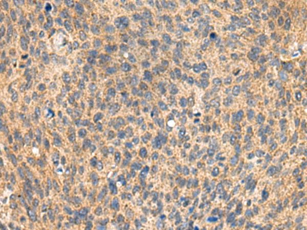 Polyclonal Rabbit anti-Human MIA / CD-RAP Antibody (IHC)