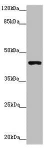 Polyclonal Rabbit anti-Human P2RX3 / P2X3 Antibody (IHC, WB)