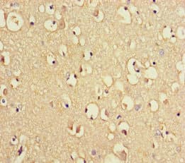 Polyclonal Rabbit anti-Human TRIM36 Antibody