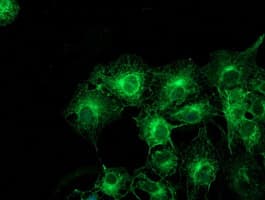 TUBAL3 Antibody (clone OTI3B7)