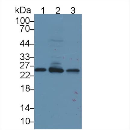 LYPLA1 Antibody (aa1-230, PE)