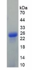 Rat GCG / Glucagon Protein (Recombinant His, N-Terminal)