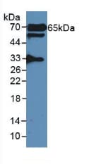 GAD65 Antibody (aa188-374)