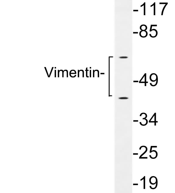 Vimentin Antibody (aa23-72)
