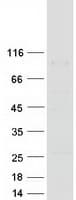 Human ATG9A Protein (Recombinant Myc-DDK (Flag))