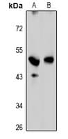Polyclonal Rabbit anti-Human GPRC5C Antibody (IF, WB)
