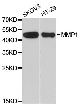 Polyclonal Rabbit anti-Human MMP1 Antibody (IHC, WB)