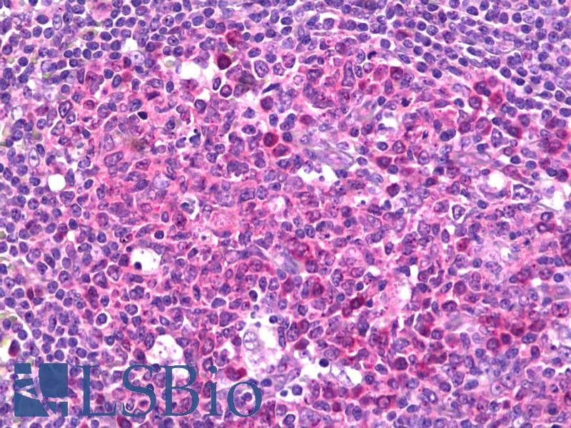 IHC-plus™ UBQLN1 / Ubiquilin Antibody (aa19-49)