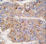IRS2 / IRS-2 Antibody (aa1309-1338)