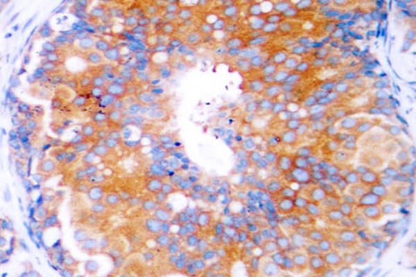 MAP2K2 / MKK2 / MEK2 Antibody (Arg388)