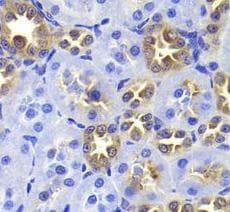 Gastric Inhibitory Peptide Antibody