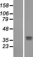 THAP10 Protein (Over-Expression Lysate Myc-DDK (Flag))
