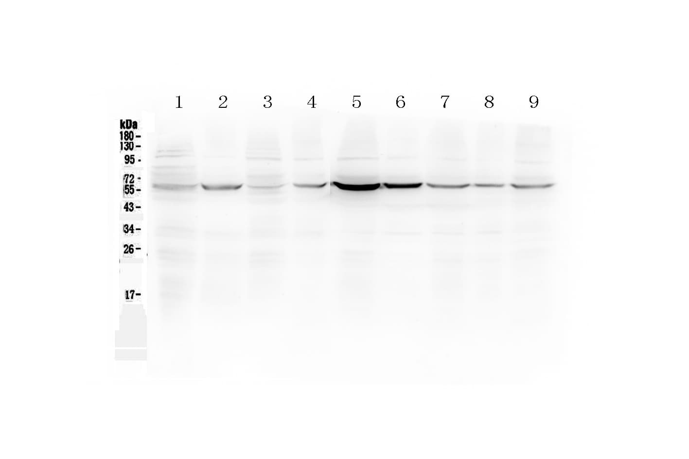 ESR2 / ER Beta Antibody