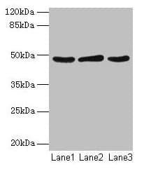 SERPINB2 / PAI-2 Antibody (aa1-416)