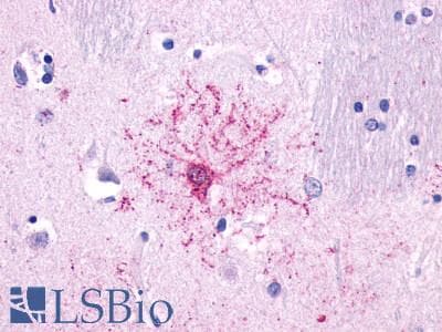 PathPlus™ Polyclonal Rabbit anti-Human NTSR2 / NTR2 Antibody (C-Terminus, IHC)
