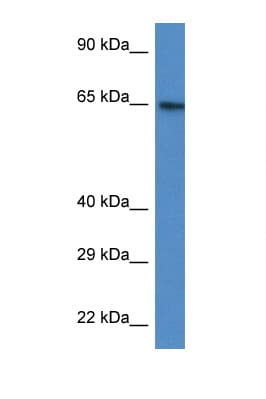 Polyclonal Rabbit anti-Human ACSS2 / ACAS2 Antibody (N-Terminus, WB)