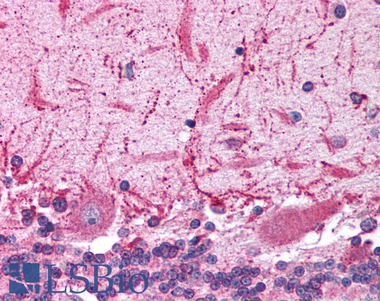 Polyclonal Rabbit anti-Human GRIK2 / GLUR6 Antibody (aa652-701, IHC, WB)