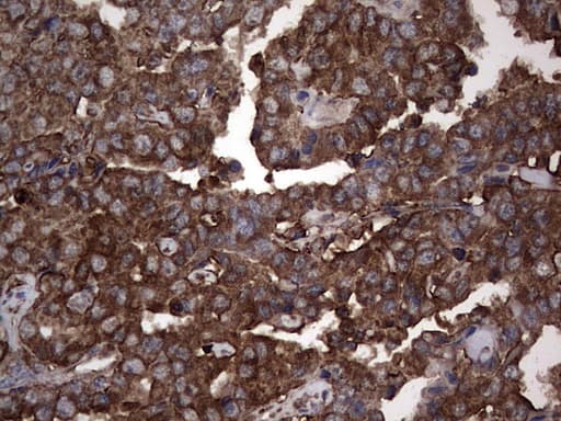 PKM2 Antibody (clone 14C7)