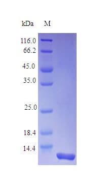 Rhesus monkey IL8 / Interleukin 8 Protein (Recombinant)