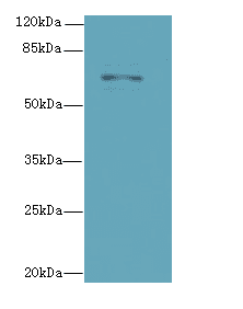 RHOBTB3 Antibody