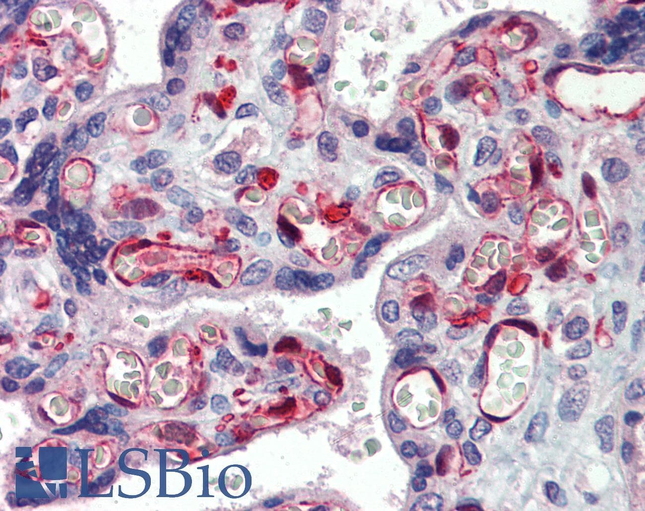 Polyclonal Rabbit anti-Human NOL5A / NOP56 Antibody (aa193-242, IHC, WB)