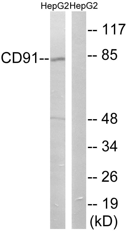 LRP1 / CD91 Antibody (aa4486-4535)