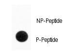 SLC29A1 / ENT1 Antibody (phospho-Ser254)