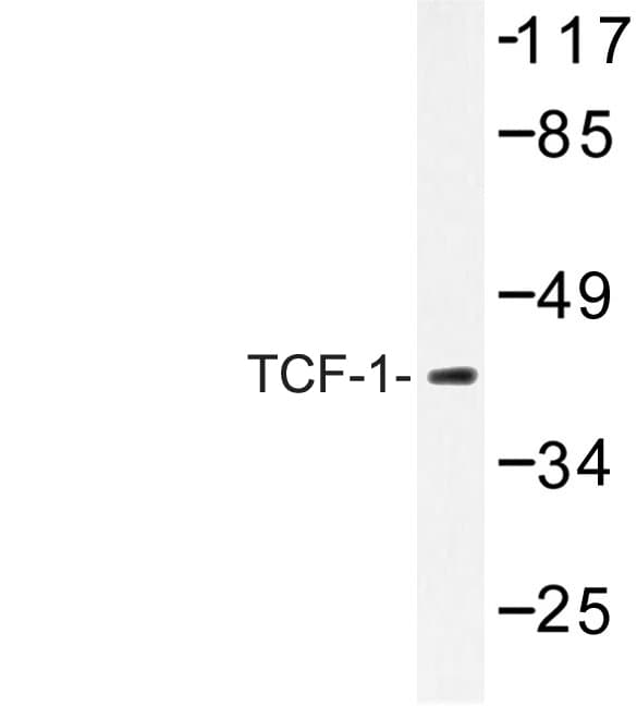 Polyclonal Rabbit anti-Human TCF7 Antibody (Phe26, IHC, WB)