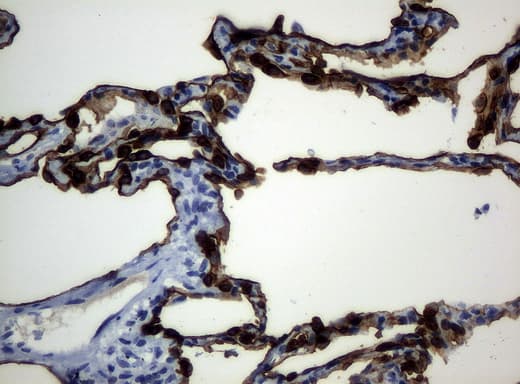 KRT19 / CK19 / Cytokeratin 19 Antibody (aa240-390, clone UMAB2)