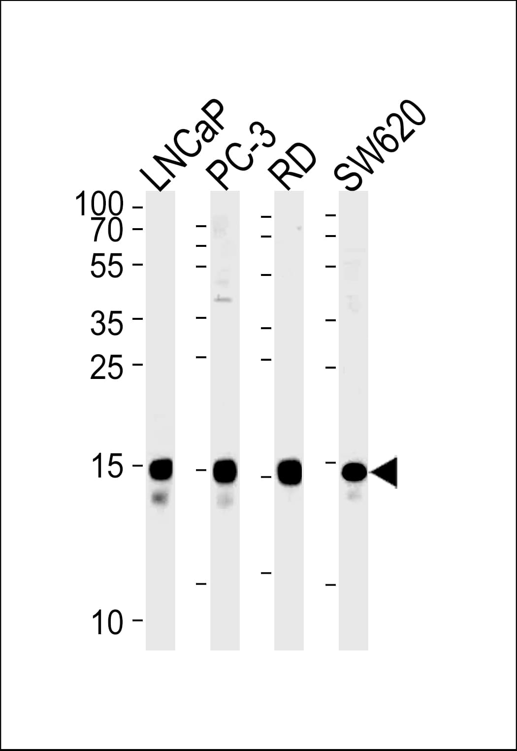 TCEAL1 Antibody (aa1-30)