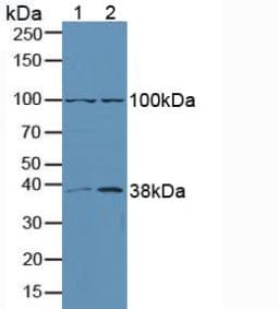 MAPK3 / ERK1 Antibody (aa75-312, APC)