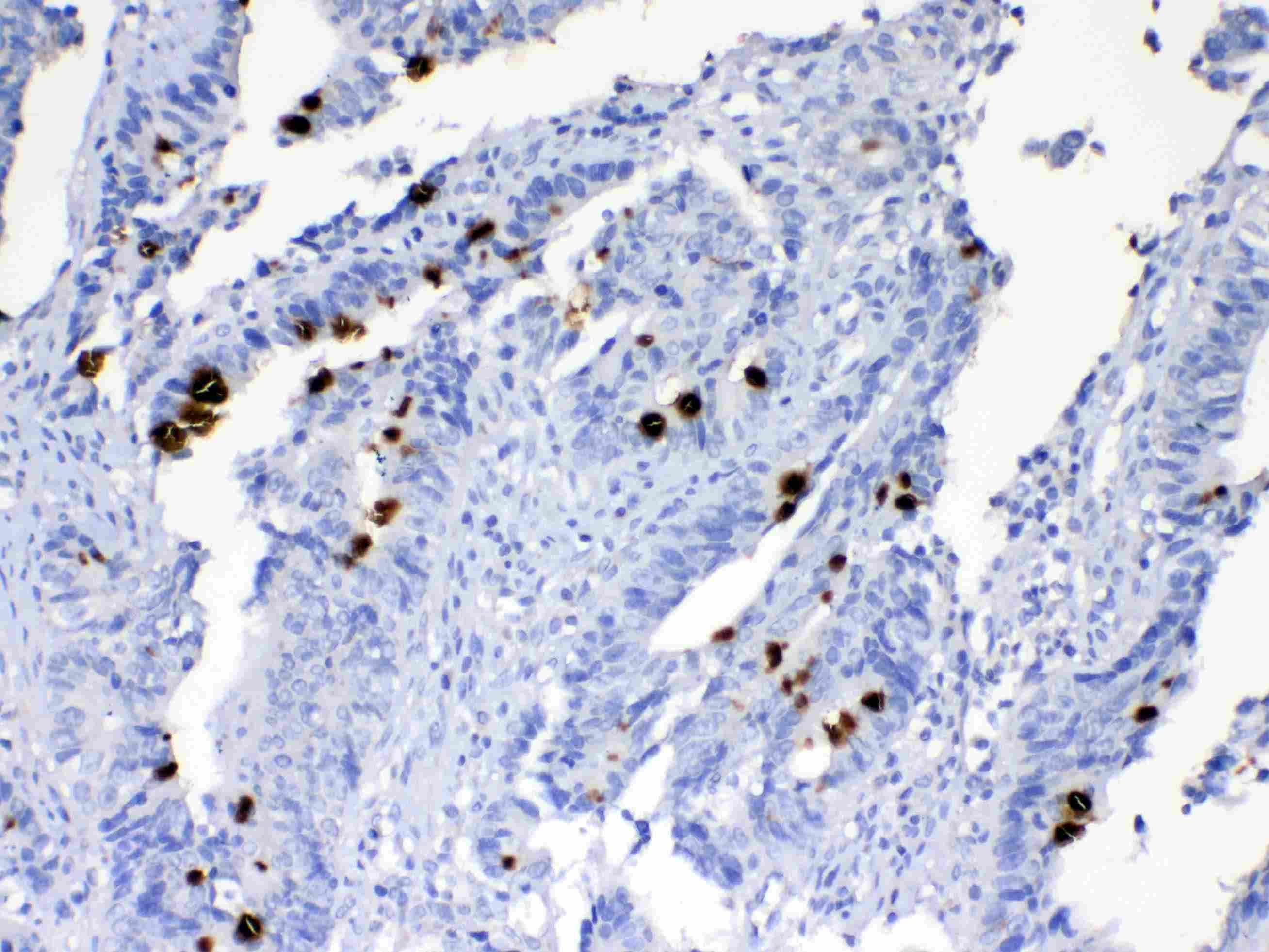 Polyclonal Rabbit anti-Human Mucin 2 / MUC2 Antibody (IHC)