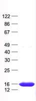 Human LYRM1 Protein (Recombinant His, N-Terminal)