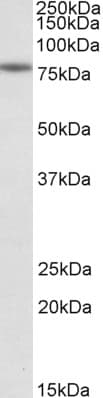 IHC-plus™ Polyclonal Goat anti-Human CAPN1 / Calpain 1 Antibody (aa515-526, IHC, WB)