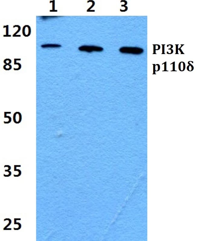 IHC-plus™ Polyclonal Rabbit anti-Human PIK3CD / PI3K Delta Antibody (IHC, WB)