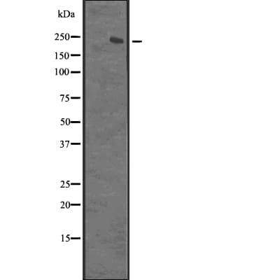 XRN1 Antibody