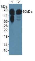 KRT5 / CK5 / Cytokeratin 5 Antibody (aa163-471)