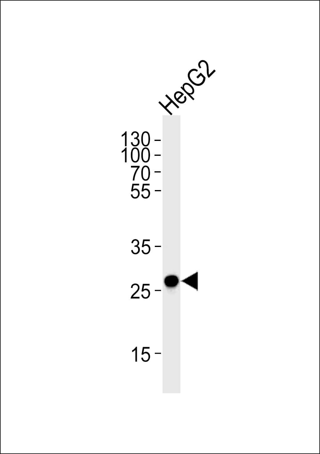 IHC-plus™ ECI1 / DCI Antibody (aa275-302)