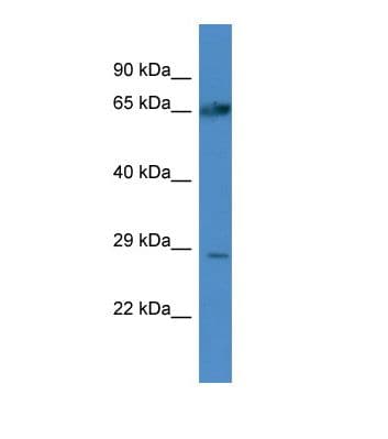 Polyclonal Rabbit anti-Human ATG4A Antibody (aa91-140, WB)